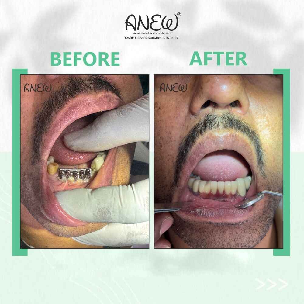 Gopal Rao Before and After image